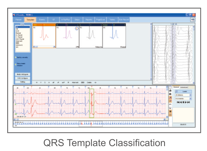 Programa CardioSW Holter mostrando la clasificación automática de plantillas QRS junto al trazo continuo
