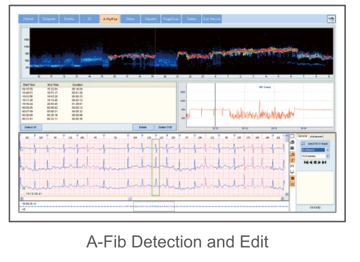 Pantalla de detección de fibrilación auricular en CardioSW Holter, con gráfico de densidad y tendencia RR