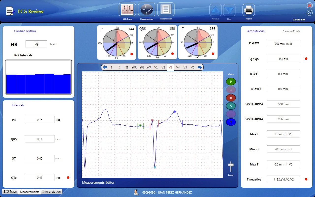 Pantalla del programa CardioSW con las mediciones del ECG: intervalos, amplitudes y ejes eléctricos