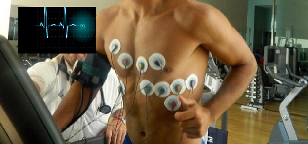 Prueba de esfuerzo con CardioSW Stress Test