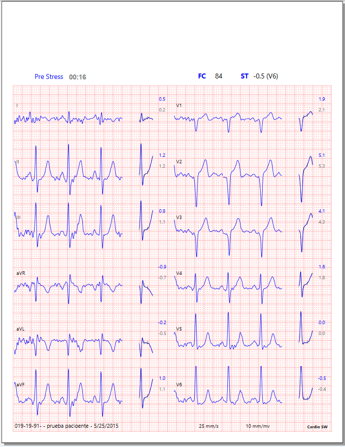 Hoja de ECG de 12 derivaciones de CardioSW Stress Test, previa al esfuerzo, con frecuencia cardíaca y segmento ST