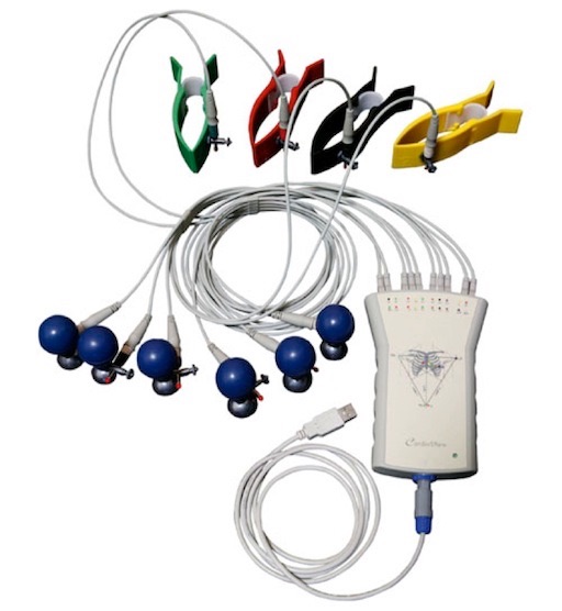 Electrocardiógrafo Cardioview CV200