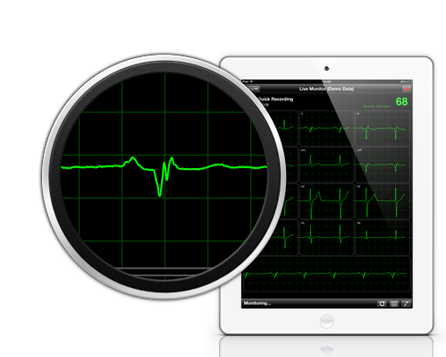 App vhECG Pro en iPad mostrando el monitoreo del ECG en tiempo real con detalle ampliado del trazo
